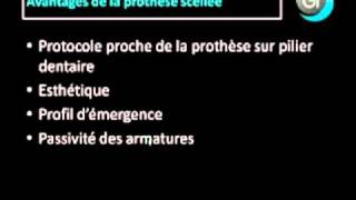 Implant dentaire : Quand réaliser de la prothèse scellée ?
