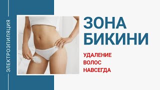 Электроэпиляция бикини