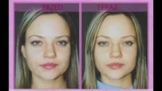 Derma Wand New