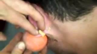 Давят громадный гнойник за ухом! Жесть!