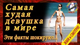 Самый худой человек в мире – история Валерии Левитиной   страшная «красота» анорексии