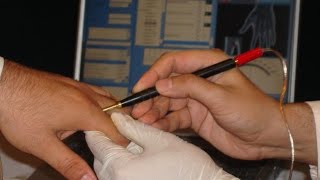 Метод Фолля. Нахождение БАТ, установка щупа и проведение измерений.