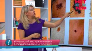 Какие родинки опасны для здоровья