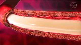 Фауна сервис: дирофиляриоз у собак и кошек. Bayer