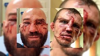 АРТЕМ ЛОБОВ ПРОТИВ ДЖЕЙСОНА НАЙТА! ПОЛНЫЙ БОЙ! ARTEM LOBOV AGAINST JASON KHIGHT! FULL FIGHT!
