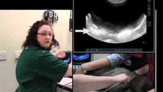 BCF Technology Abdominal Ultrasound Video 7 -- Ultrasound exam of the urinary bladder