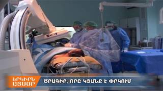 Սրտի անվճար ստենտավորման ծրագրից հետո վիրահատության գինը կտրուկ իջել է