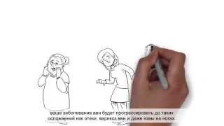 Что вы должны знать о хронической венозной недостаточности?