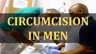 CIRCUMCISION IN MEN