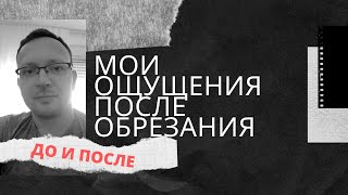 ✅ Обрезание крайней плоти у мужчин | Мои ощущения ДО и ПОСЛЕ