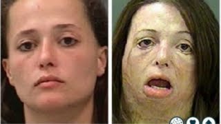 The Shocking Faces of Meth Campaign