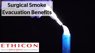 Operating Room Surgical Smoke Evacuation Benefits | ETHICON