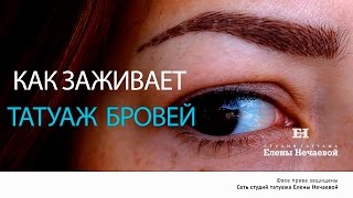 После татуажа. Видео отчет по дням.