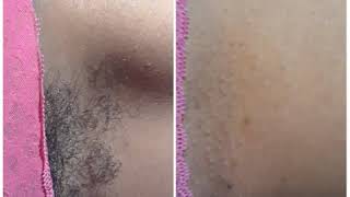 ?? Waxing Women's Underarm Using Cirepil Hard Wax| Whitney's Mobile Body Wax|Matthews,NC