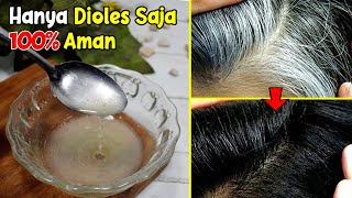 CARA MENGHILANGKAN UBAN SECARA ALAMI AGAR TIDAK TUMBUH LAGI [ SUDAH TERBUKTI] 