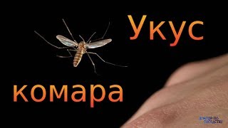 ЛЕЧЕНИЕ КОМАРИНЫХ УКУСОВ / TREATMENT OF MOSQUITO BITES
