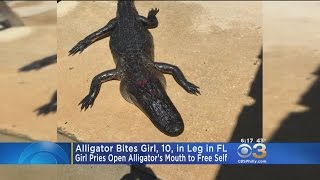 Alligator Bites Girl, 10, in Leg in FL