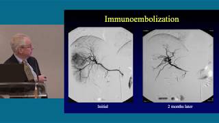 Liver Directed Therapies: 2019 CURE OM Symposium