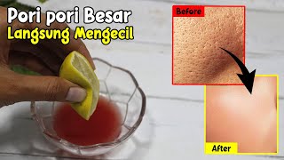 SANGAT MANJUR… CARA MENGATASI PORI-PORI BESAR DI WAJAH SECARA ALAMI [SUDAH TERBUKTI]