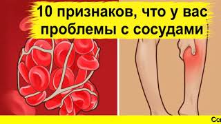 атеросклероз сосудов нижних конечностей лечение