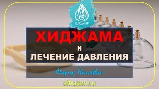 Хиджама нормализует давление ч 1 Обучение хиджаме