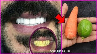 কালো ও দুর্বল দাঁতকে চকচকে ও মজবুত করার উপায়।Teeth Whitening Home Remedies