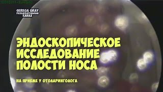 Эндоскопическое исследование полости носа [20170112]