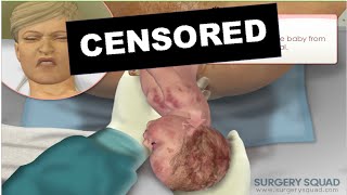 ÇIKARIYIMMI? - Child Birth Simulator +18
