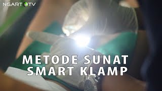 INILAH METODE SUNAT SMART KLAMP, TANPA DIJAHIT