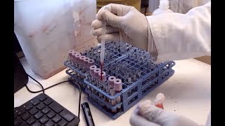 The Indus Hospital Blood Center | Documentary