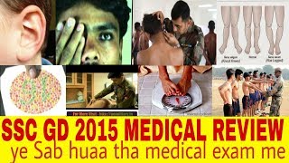 SSC GD 2017 Medical Exam Review, इस तरह हुआ था ssc gd का मेडिकल परीक्षा जरूर देखें