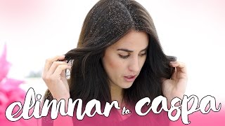 Trucos y consejos para combatir la caspa | Patry Jordan