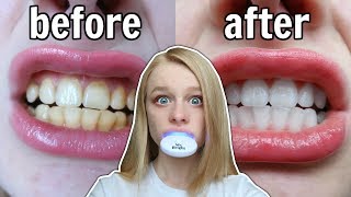 I tried WHITENING MY TEETH for the FIRST TIME! ? *at home*