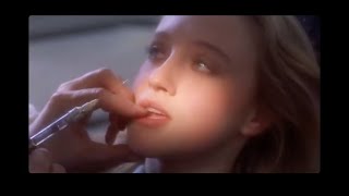 Wisdom Teeth