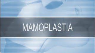 Mamoplastia - Cirurgia Plástica Porto Alegre - Cirurgião Plástico Dr. André Valiati