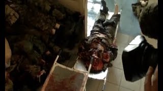 В больницах Донецка 43 раненых, в моргах - 36 погибших