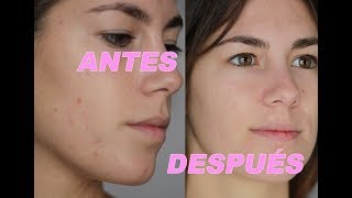 ¿Es realmente milagroso el tratamiento Swiss Clinic?