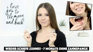 ZÄHNE WERDEN WIEDER SCHIEF!! - MEIN FAZIT NACH 7 MONATEN OHNE ZAHNSPANGE