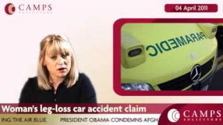 Woman's leg-loss car accident claim