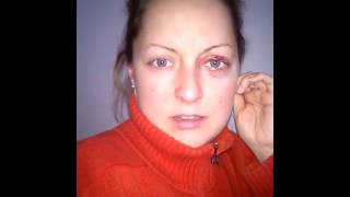 Auge Teil 1 nach OP - einen Tag nach dem Eingriff... - Kurzer Vlog