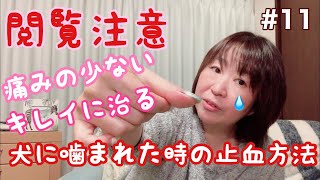 【閲覧注意】犬に噛まれた傷の痛みを少なくする方法