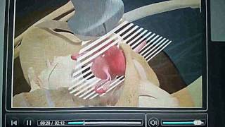 Ultrasound Guided Pelvic Exam (Medical Education & Training)