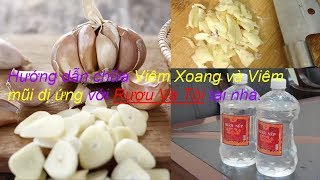 Cách điều trị viêm xoang, viêm mũi dị ứng tại nhà đơn giản mà hiệu quả  - Nhận dạng cây thuốc