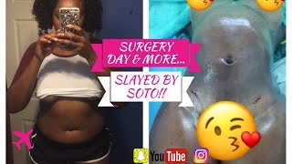 SURGERY DAY !!! : Get Me Bodied By Soto