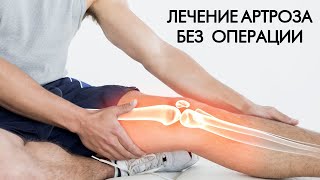 Лечение артроза без операции