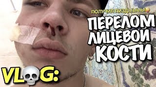 VLOG: МНЕ СЛОМАЛИ ЛИЦЕВУЮ КОСТЬ / Андрей Мартыненко