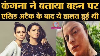 Kangana ने बहन Rangoli पर acid attack के बाद के समय को career का बुरा दौर बताया | Panga | Chhapaak