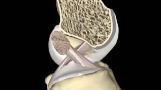 Anatomia e biomecânica  do joelho - Ligamento Cruzado Anterior (LCA), ligamento colateral lateral.