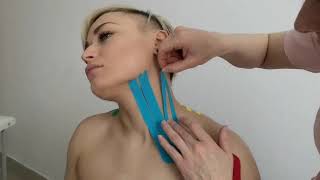 Эстетическое тейпирование зоны шеи