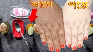 কালো থেকে দুধের মতো ফর্সা হওয়ার উপায়। উজ্জ্বল ফর্সা এবং লাবণ্যময় চেহারা পাওয়ার টিপস।